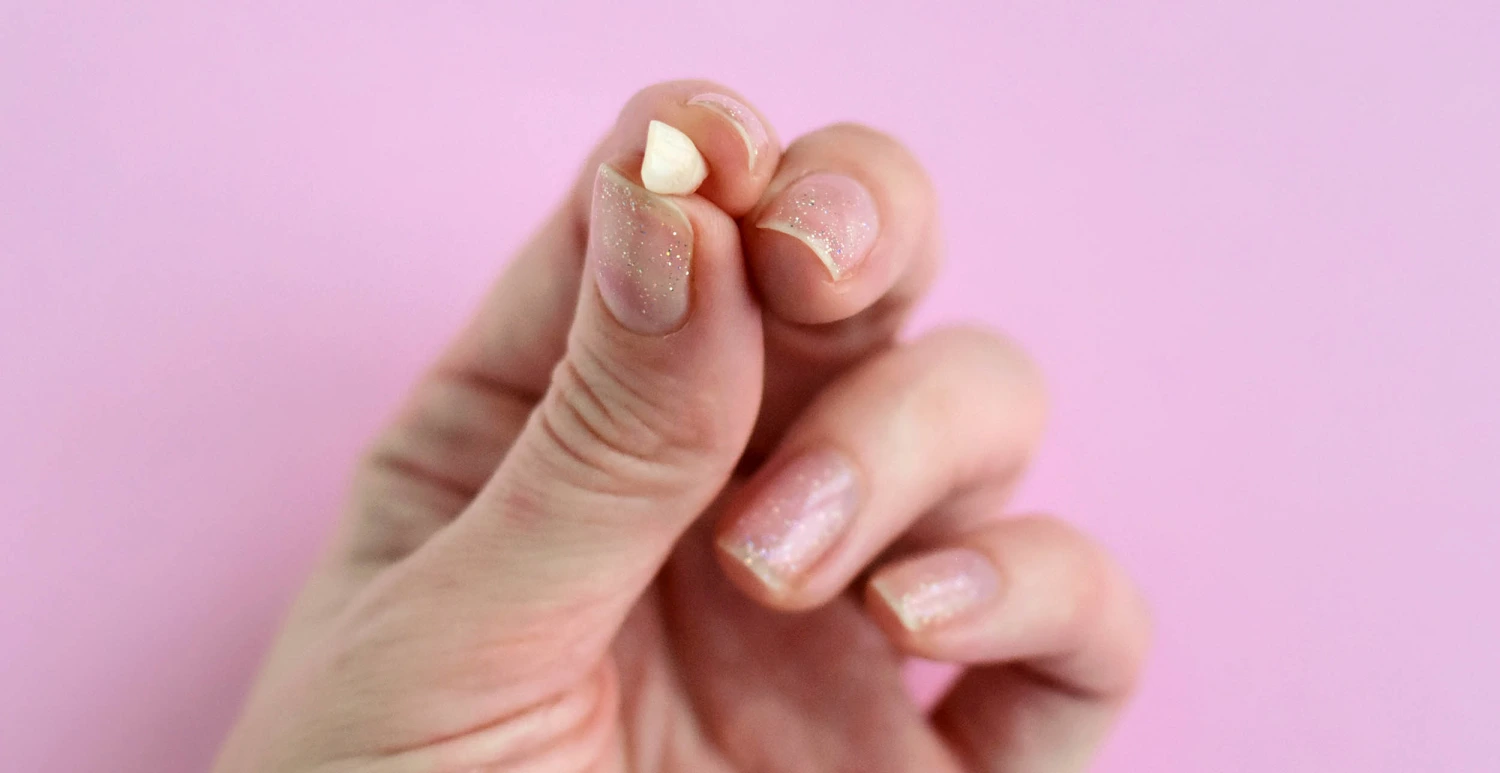 dream-lost-tooth-teeth-mc-230814-a29348